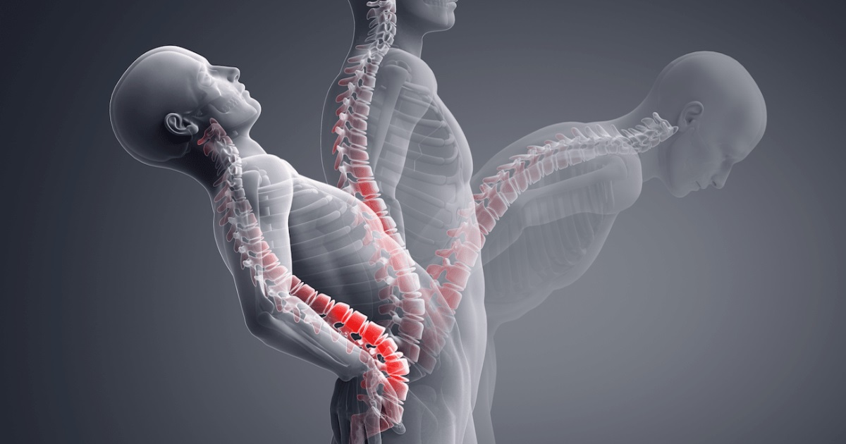 Chiropraxie & Motifs de Consultations